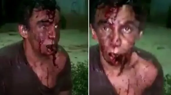  سگ نگهبان خانه دزد را بدجوری لت و پار کرد+ فیلم دزد (+14)