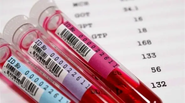 ارتباط  گروه خونی افراد با سکته مغزی