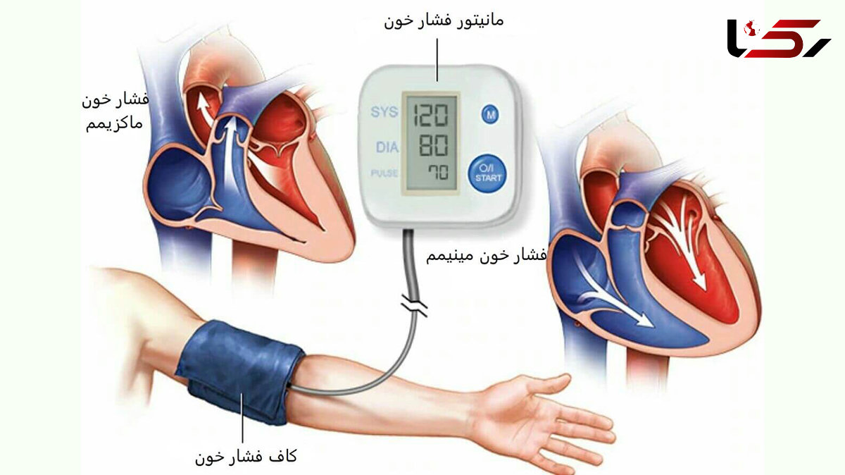 یافته‌های مهم درباره فشار خون بالا 