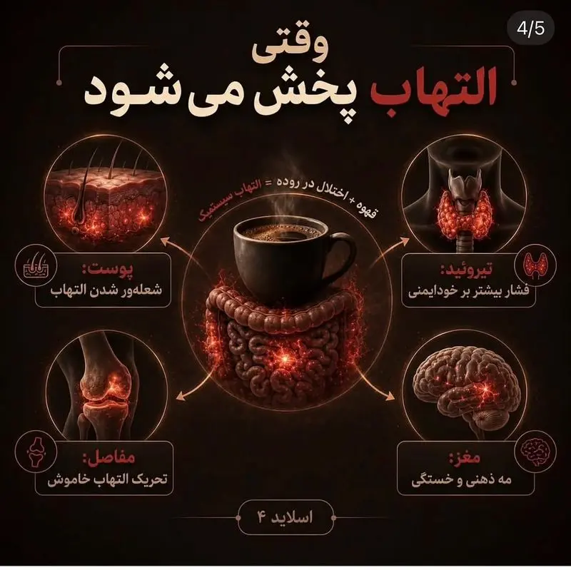 التهاب روده