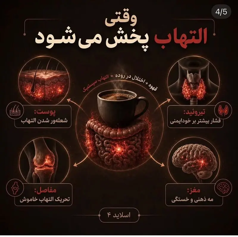 التهاب روده