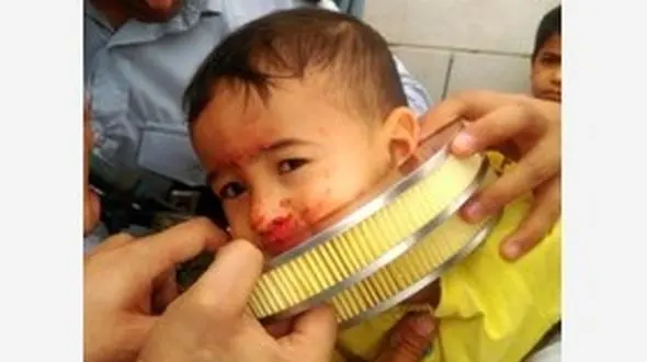 دردسر عجیب برای پسر خردسال بازیگوش + عکس