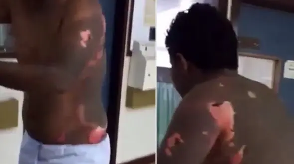 زن جوان وقتی فهمید شوهرش می خواهد دوباره ازدواج کند، او را با روغن داغ تنبیه کرد!+ فیلم