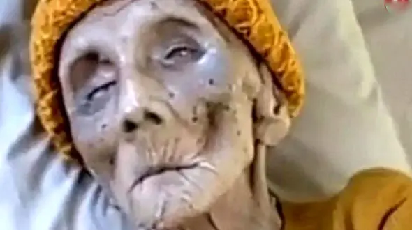 ترسناک ترین پیرزن جهان + فیلم باورنکردنی اسکلتی که هنوز جان دارد !