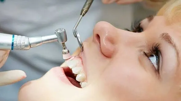 چرا دندان هایمان زرد می شود؟/ 7 عامل جرم های دندانی
