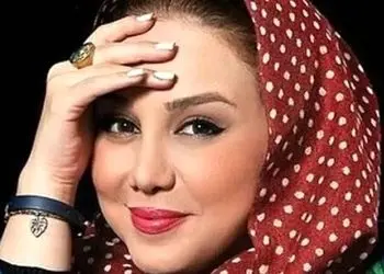 نگاهی به چهره بهنوش بختیاری قبل از عمل زیبایی بینی/ واقعا  خیلی هم نیاز به عمل نداشت!