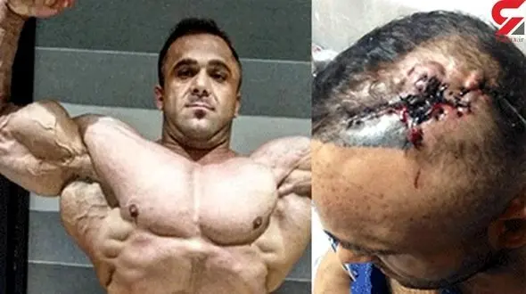 بازگشت هرکول ایرانی پس از حمله هولناک + فیلم و عکس