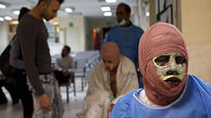 3 کشته و 227 زخمی در چهارشنبه سوری که هنوز نیامده