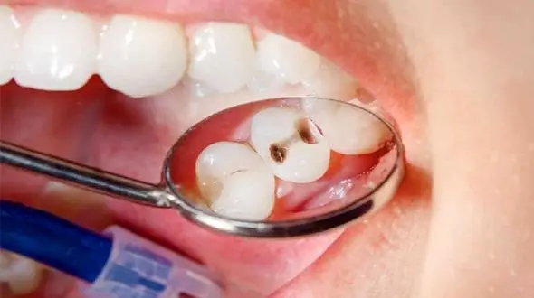 راهکارهای طلایی برای پیشگیری از افتادن دندان‌ ها با افزایش سن