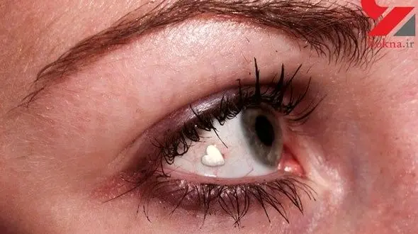 ناقص شدن دختر جوان ایرانی در لاکچری ترین عمل زیبایی! + عکس