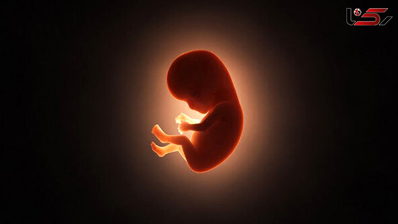 وقوع سالی بیش از ۴۰۰ هزار سقط جنین در کشور / استفاده از لوازم پیشگیری از بارداری ممنوع نشده است