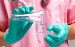سرطان دهانه رحم در کشورهای جهان سوم شایع تر است / لزوم گسترش پاپ اسمیر و واکسیناسیون HPV برای کنترل "سرویکس"
