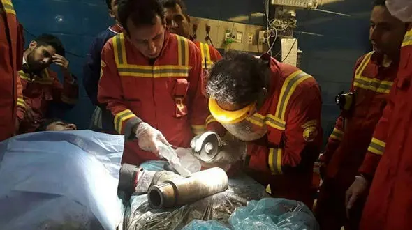 چرخ‌گوشت دست مرد جوان تهرانی را بلعید +تصاویر دلخراش