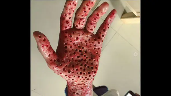 گریم چندش‌آور یک دانشجو برای دریافت بورسیه+عکس