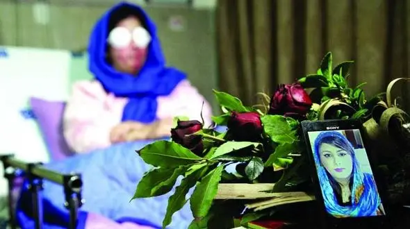 ناگفته های تکاندهنده سهیلا جورکش قربانی اسیدپاشی سریالی اصفهان + عکس