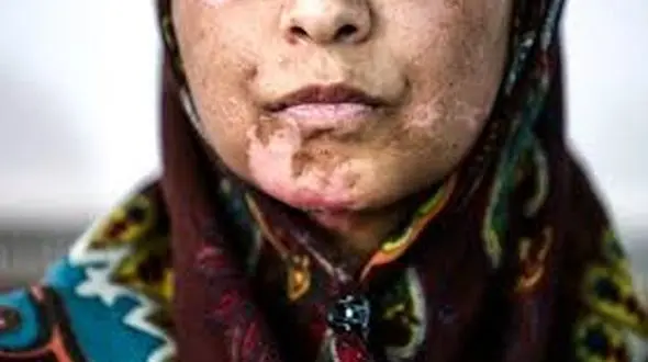  محاکمه مرد مشهدی بخاطر 21 روز شکنجه اعظم و بچه هایش