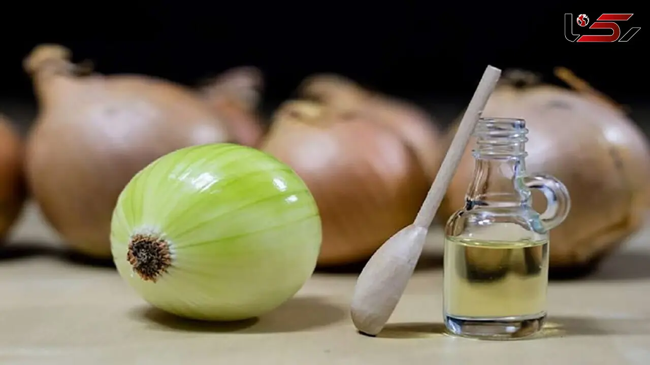 درمان ریزش مو با آب پیاز 