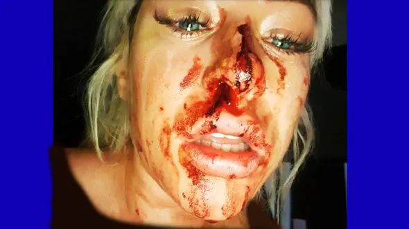 زن زیبا بدجوری زشت شد! +عکس