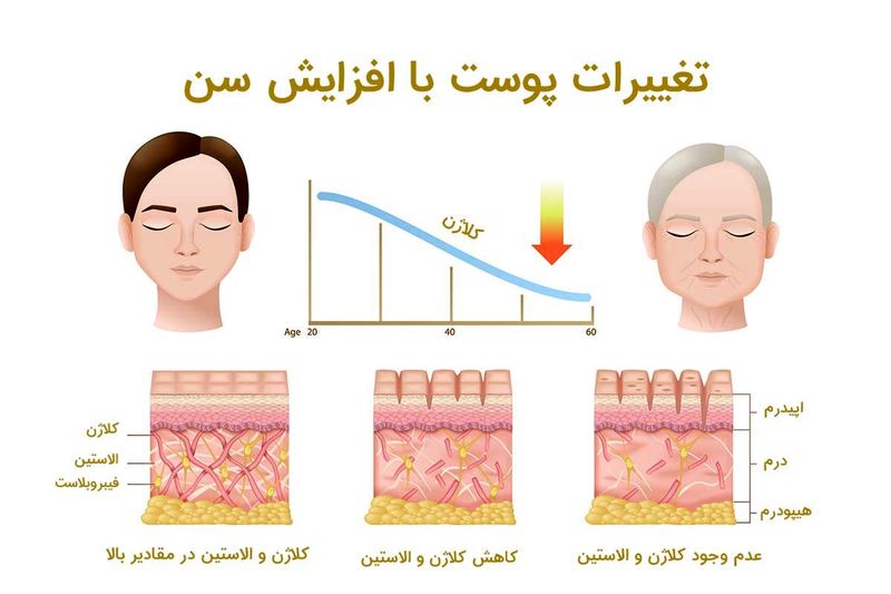 تغییرات پوست با گذر عمر