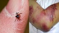 افزایش مبتلایان تب کریمه کنگو در ایران به ۶۳ نفر / لزوم تشدید مراقبت ها در مشاغل مرتبط با دام + نقشه شیوع بیماری در ایران
