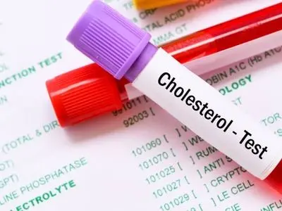 غذاهایی که سرشار از کلسترول بد هستند و خوردن آنها سم است