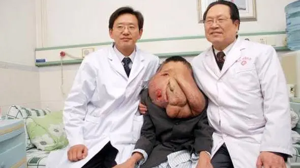  زشت ترین فرد دنیا کیست؟ / دل هر کسی به درد می آید + عکس