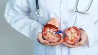 مشکلات گوارشی در کمین بیماران پیشرفته کلیوی