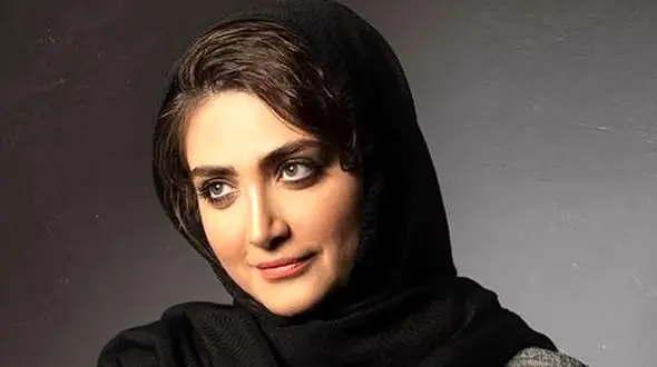 تغییر چهره خاص الناز ملک سیمای سریال زخم کاری در 29 سالگی + عکسی که وایرال شد