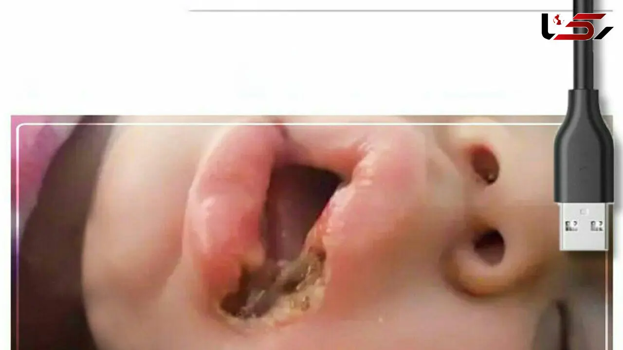 مرگ دردناک دختر 2 ساله با شارژر موبایل در حیدرآباد + عکس جسد