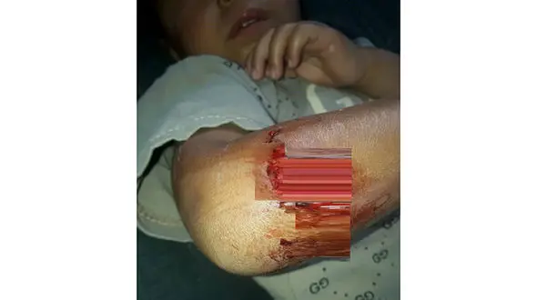 سرنوشت کودک سیل‌زده خوزستانی میان دندان های گرگ وحشی+ عکس دلخراش