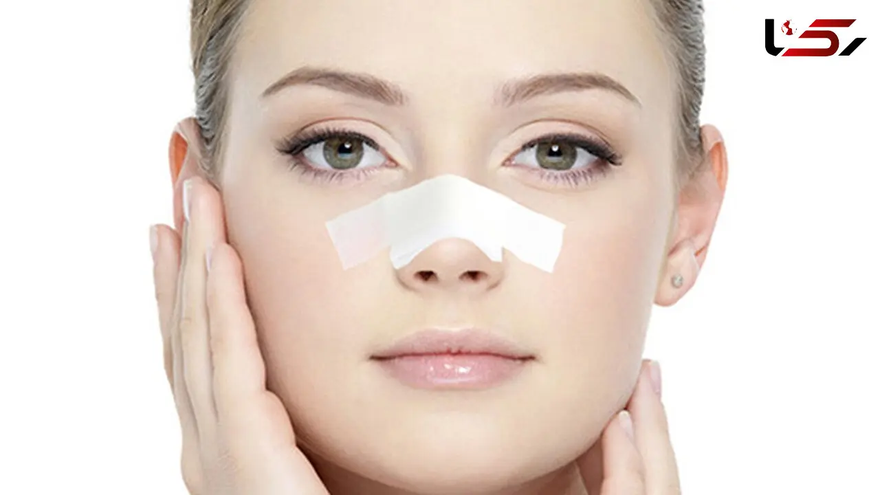 هر آنچه باید درباره چسب زدن بینی بدانید