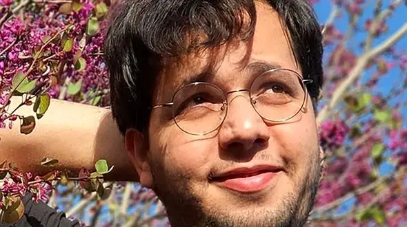 قیافه سمی حامد سلطانی قبل کاشت مو  / فکر می کردید قیافش داغون باشد ! + عکس ها