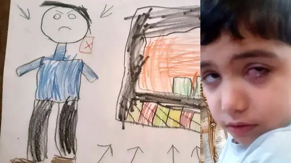 چشم یک دانش آموز 7 ساله در مدرسه دچار آسیب شد / پدر دانش آموز: از مسئولان مدرسه و آموزش و پرورش هیچ خبری نیست