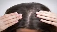 روش های طبیعی برای افزایش تراکم مو
