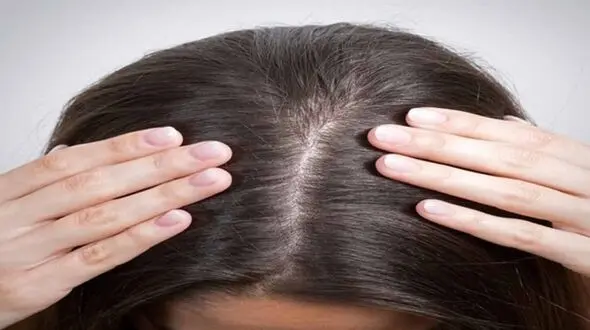 روش های طبیعی برای افزایش تراکم مو