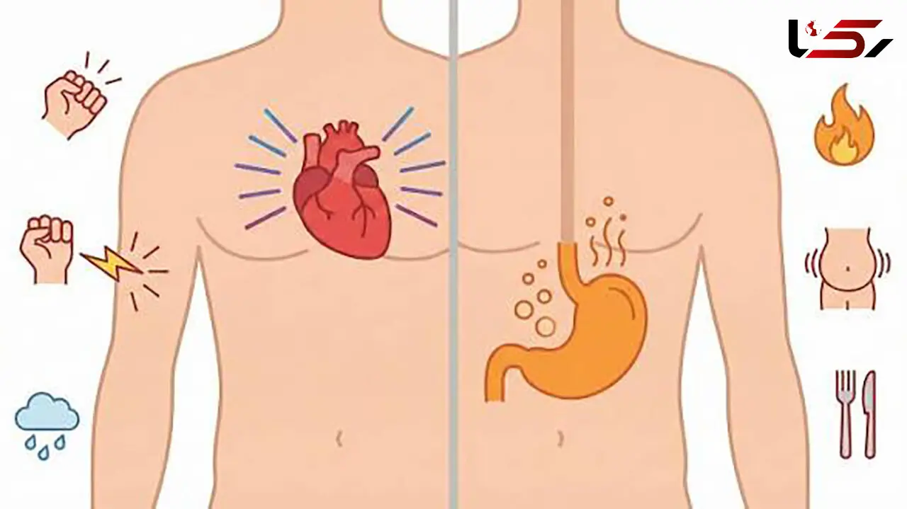 حمله قلبی یا رفلاکس معده؟ چگونه تفاوت این 2 را تشخیص دهیم؟