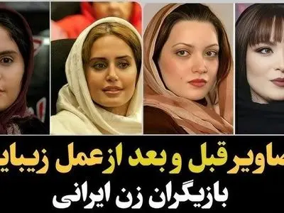 فیلم/ تغییر چهره باورنکردنی و هوش‌پران بازیگران زن پس از عملهای زیبایی؛ سحر دولتشاهی، الناز حبیبی، نیوشا ضیغمی و...