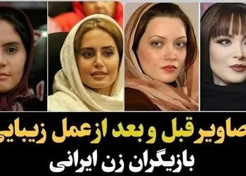 فیلم/ تغییر چهره باورنکردنی و هوش‌پران بازیگران زن پس از عملهای زیبایی؛ سحر دولتشاهی، الناز حبیبی، نیوشا ضیغمی و...