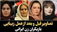 فیلم/ تغییر چهره باورنکردنی و هوش‌پران بازیگران زن پس از عملهای زیبایی؛ سحر دولتشاهی، الناز حبیبی، نیوشا ضیغمی و...