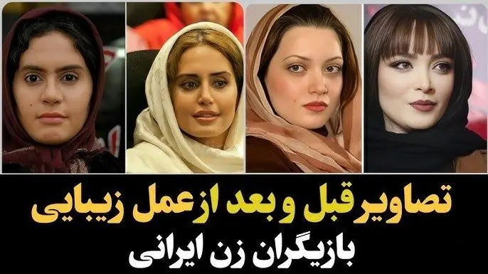 تغییر چهره باورنکردنی و هوش‌پران بازیگران زن پس از عملهای زیبایی؛ سحر دولتشاهی، الناز حبیبی، نیوشا ضیغمی و...