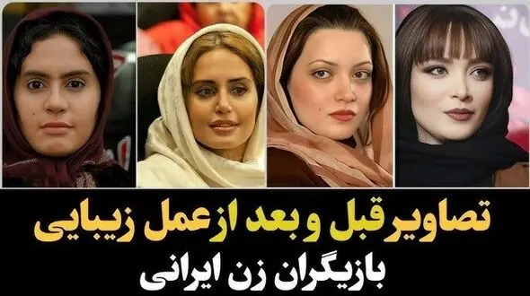 فیلم/ تغییر چهره باورنکردنی و هوش‌پران بازیگران زن پس از عملهای زیبایی؛ سحر دولتشاهی، الناز حبیبی، نیوشا ضیغمی و دیگر خانم بازیگران