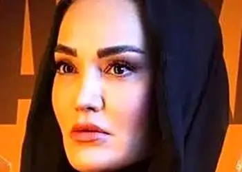 فیلم / سولماز حسینی بازیگر سریال شغال :بهم میگن صورتت زشت پیره ..../ اینجوری بهم توهین کردن .../ امیدوارم اونایی که صورتشون زیبا و ...