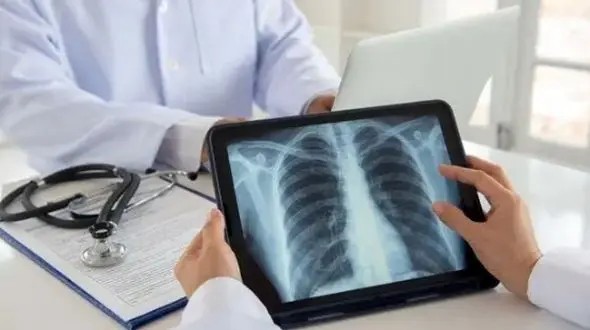 کشف علت اصلی 85 درصد موارد سرطان ریه