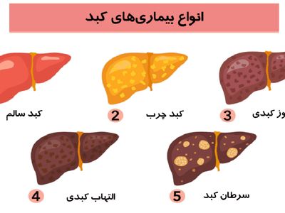 14 مورد از رایج ترین علائم کبد چرب
