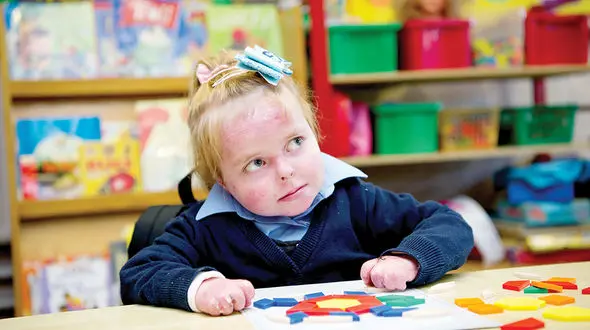 بیماری پروانه‌ای / پروانه‌های بدون بال را دریابیم