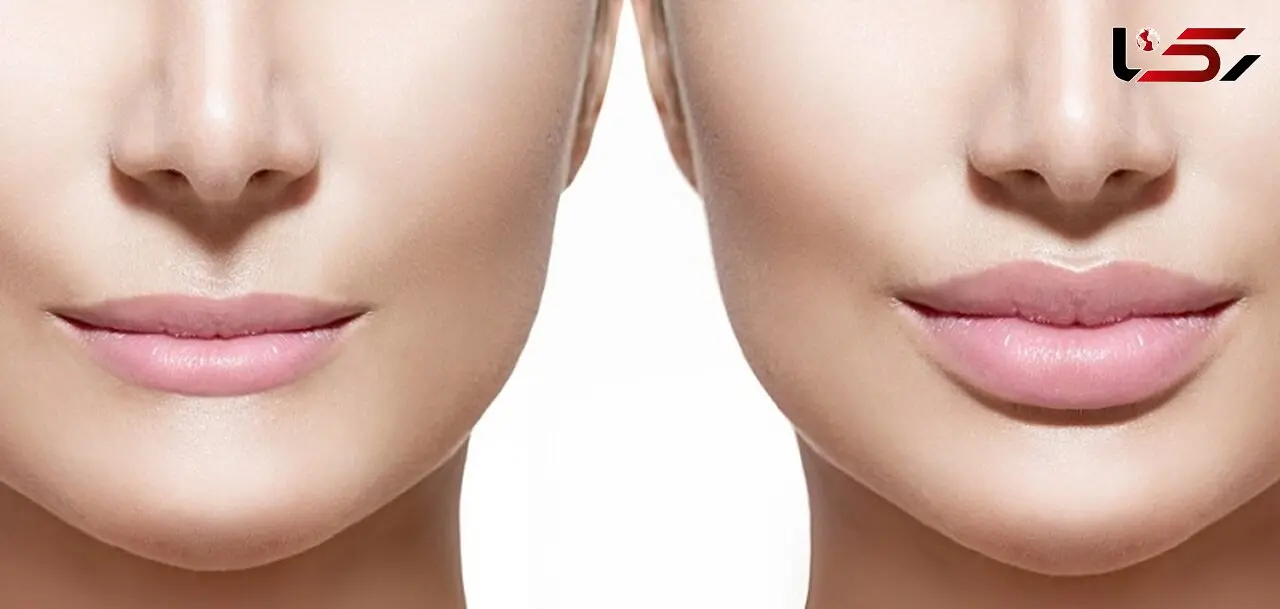 ترفندهای برجسته کردن لب بدون جراحی
