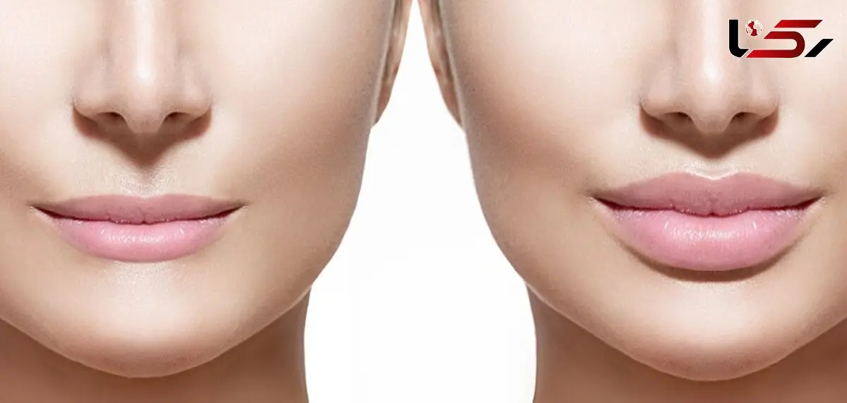 ترفندهای برجسته کردن لب بدون جراحی