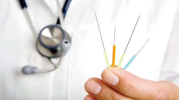 طب سوزنی چطور عمل می کند ؟ / چربی‌ سوزی با سوزن 