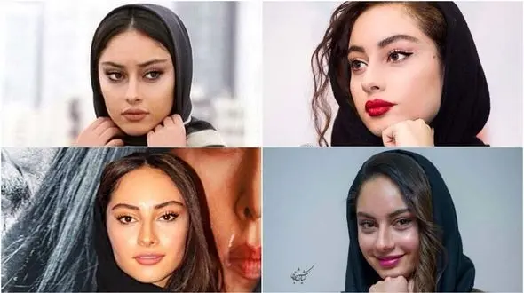 واقعیت عمل های زیبایی ترلان پروانه / با این فیلم صفر تا صد تغییراتش لو رفت !+ فیلم