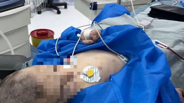 دکتر جراح راز شکنجه های دختر 3 ساله را در قم فاش کرد / بازداشت نامادری + فیلم و عکس ناراحت کننده